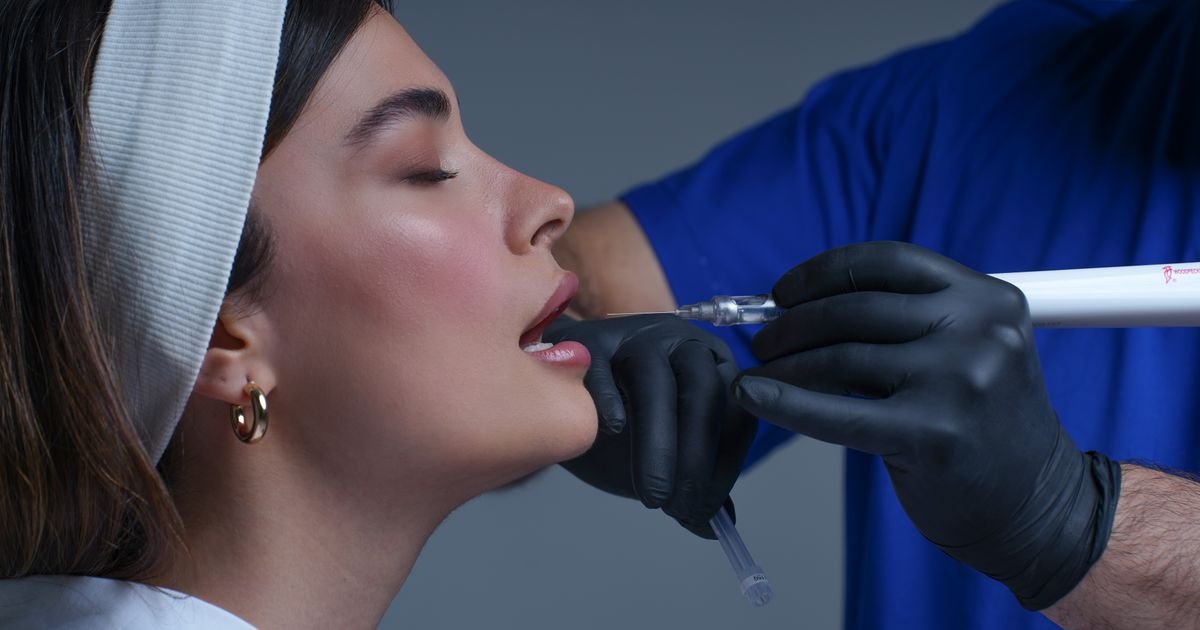 Procedimento estético no rosto — toxina botulínica (botox) em Patos de Minas e Varjão de Minas